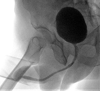 Postoperativ: Nach der Operation