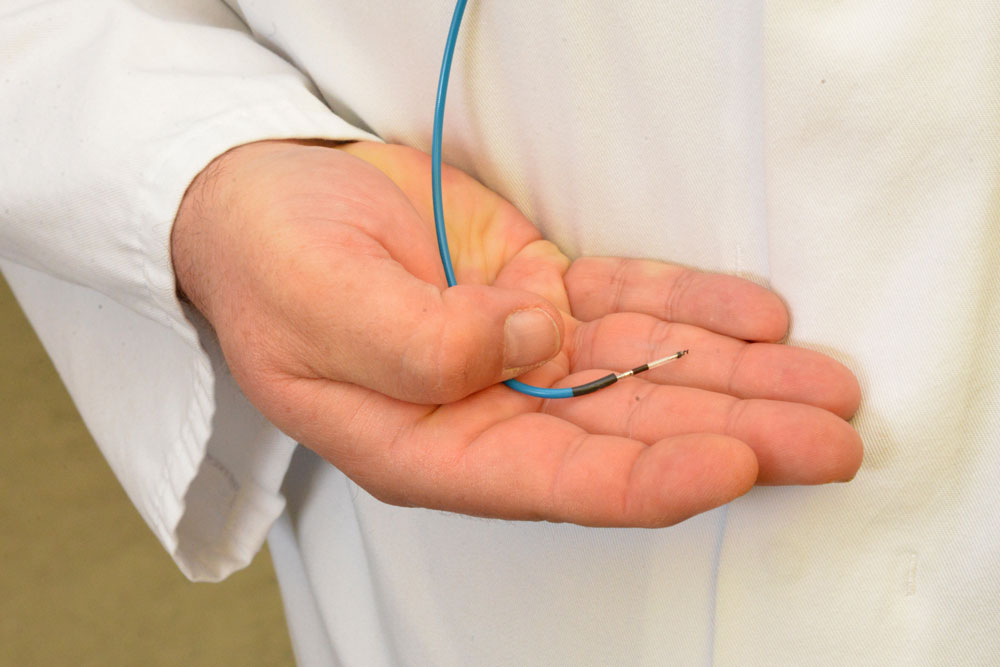 Die neue Kathetertechnik: Durch eine verformbare Schleuse wird die Elektrode zum Herz geschoben und kann dort optimal platziert werden.